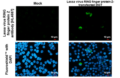 Anti-Lassa virus RING finger protein Z antibody [HL4687] used in Immunocytochemistry/ Immunofluorescence (ICC/IF). GTX644688
